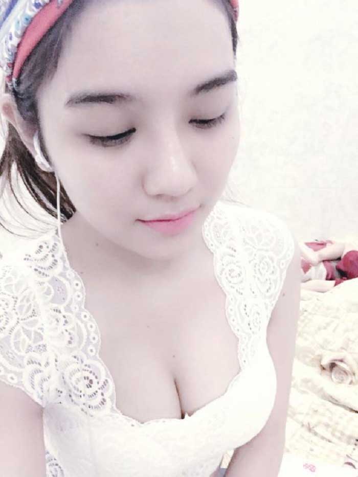 Nâng mũi bọc sụn