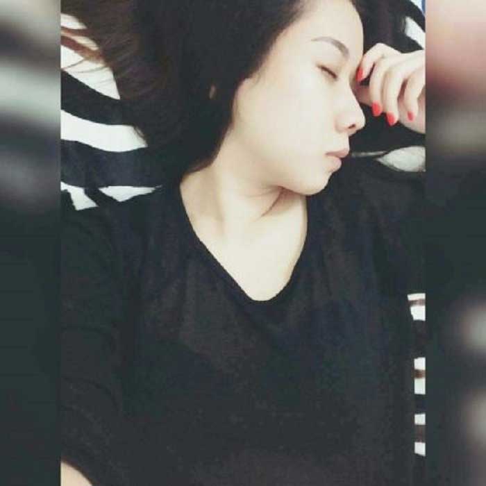 Nâng mũi bọc sụn