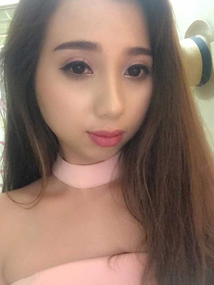 Bấm mí Hàn Quốc