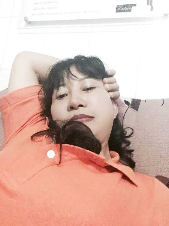 Căng da mặt