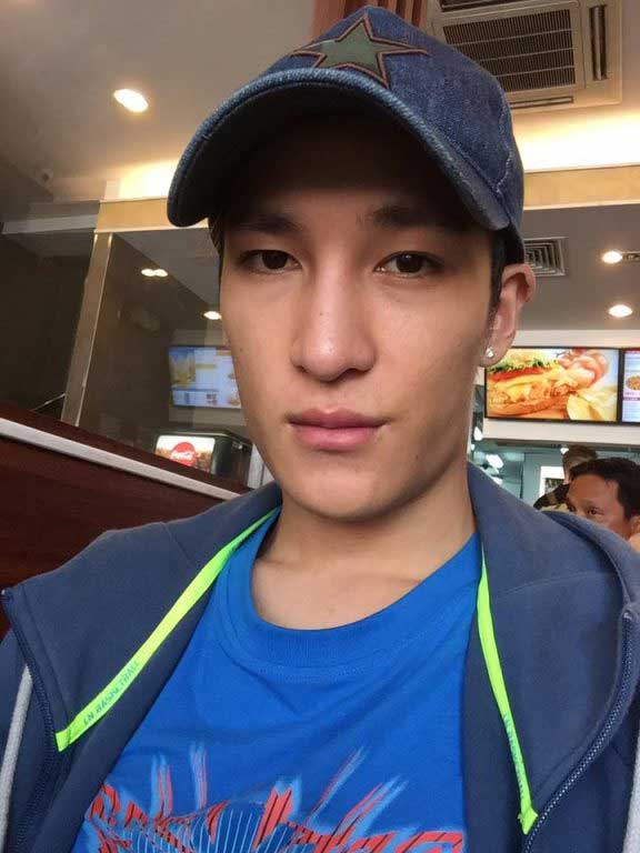Làm đầy môi