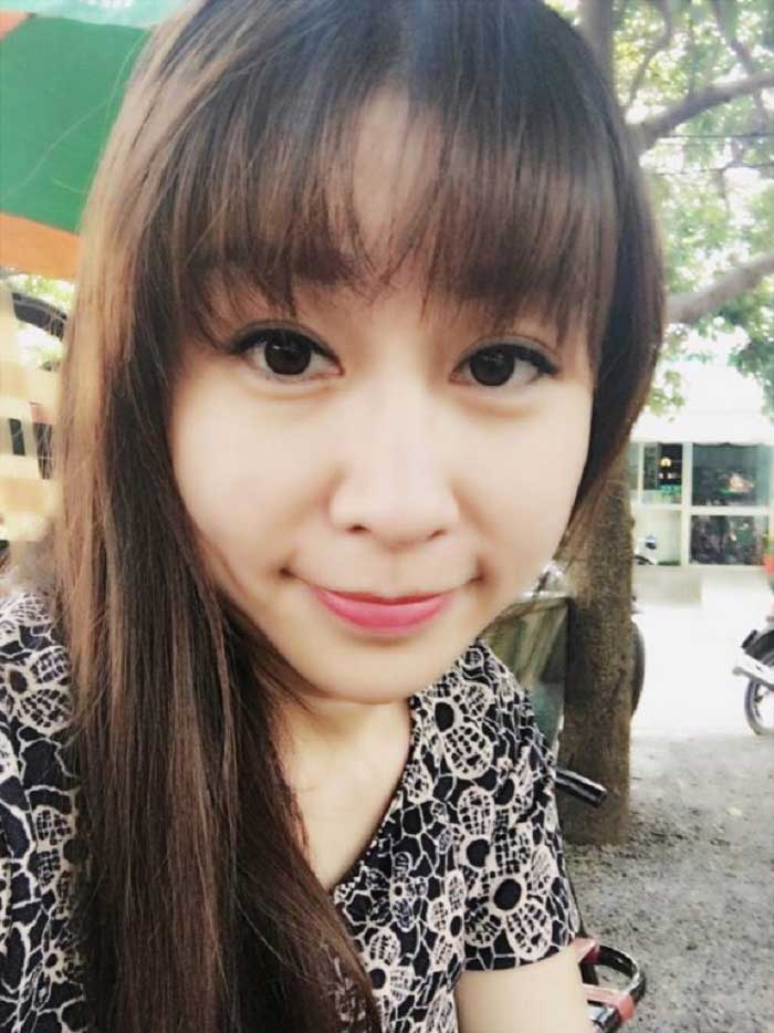 Cắt mí mắt