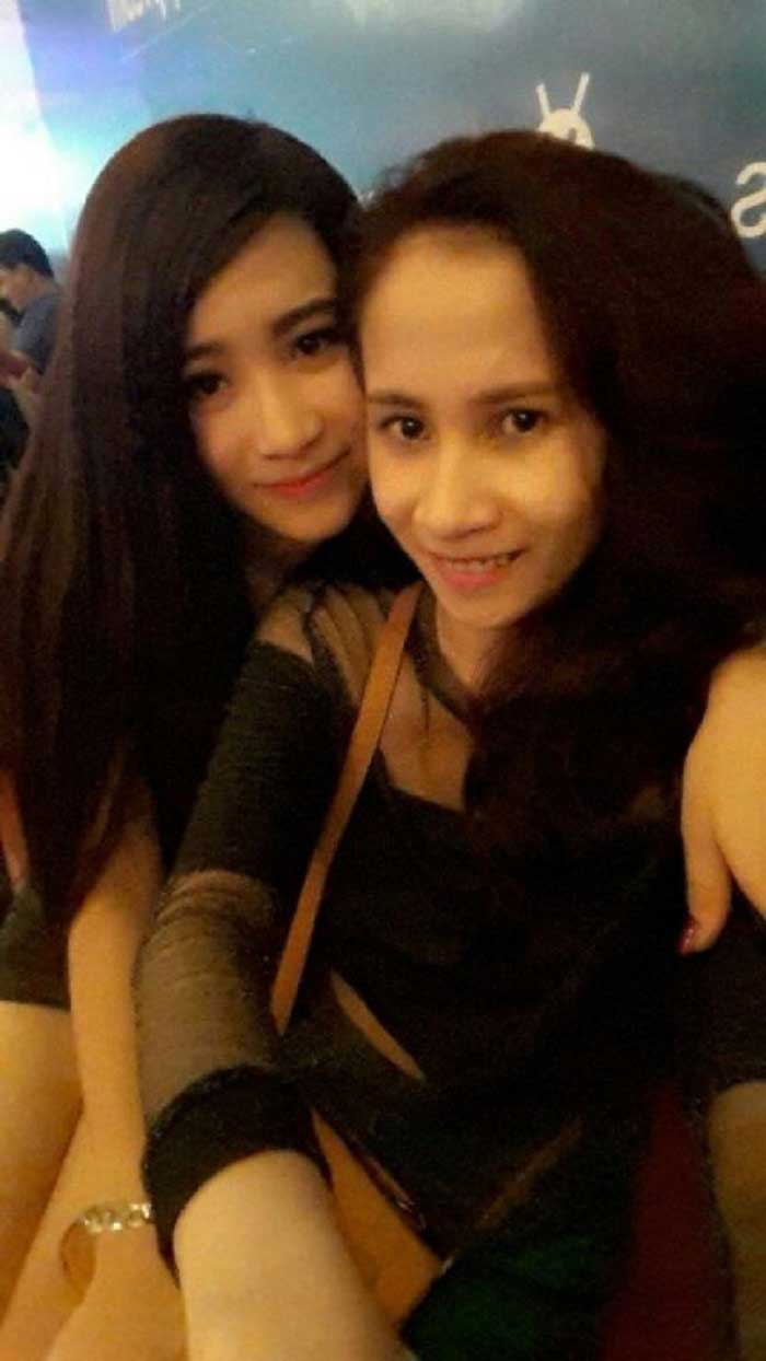 Nâng mũi bọc sụn