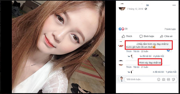 Nâng mũi bọc sụn