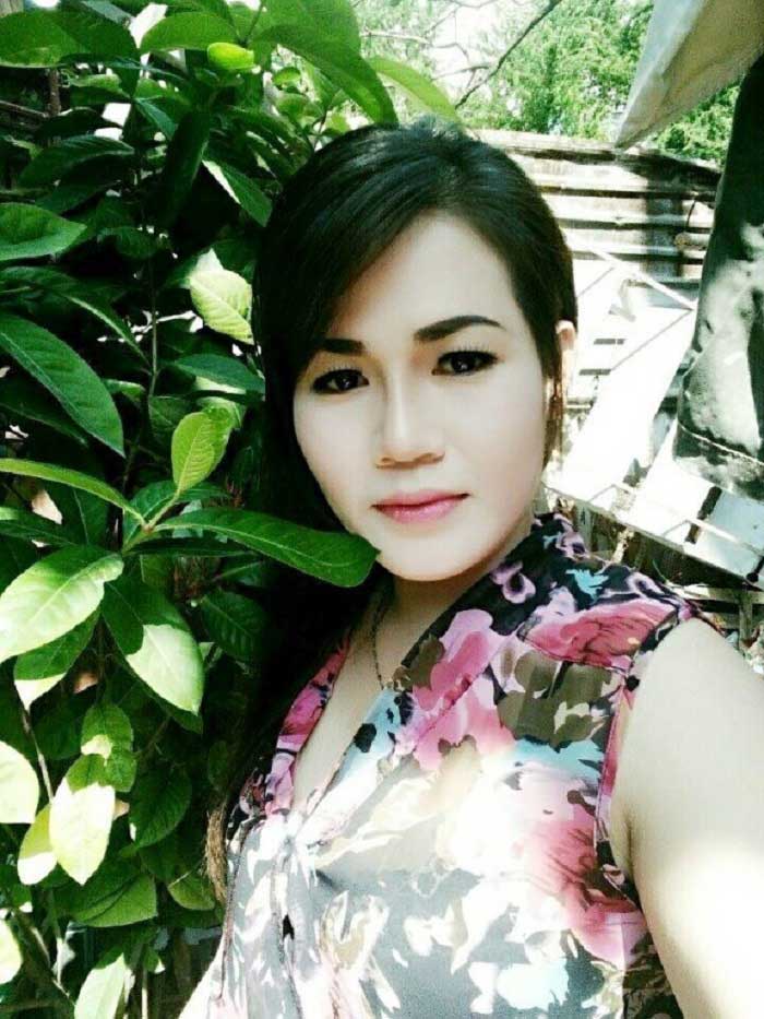 Nâng mũi bọc sụn