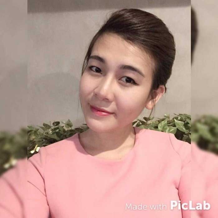 Nâng mũi Hàn Quốc