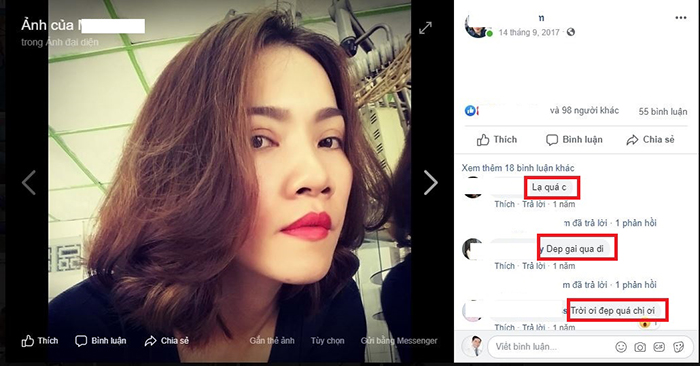 Cắt mí mắt