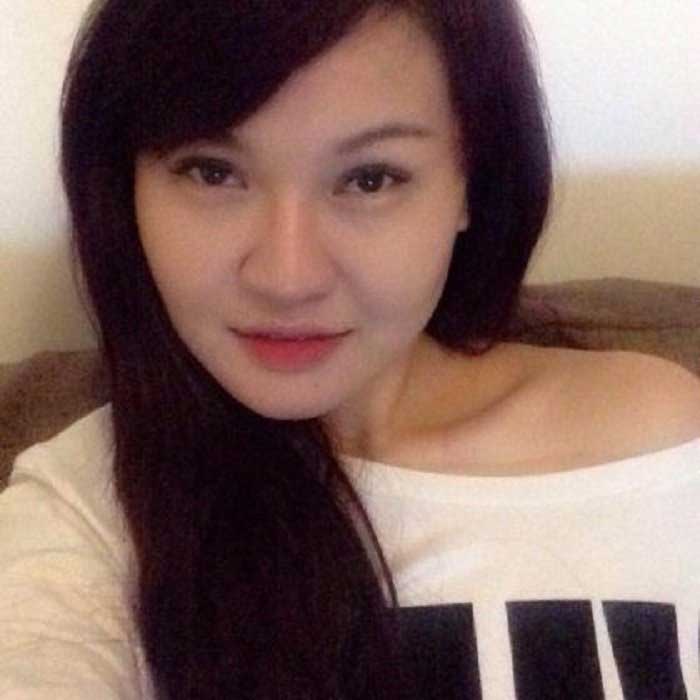 Cắt mí mắt