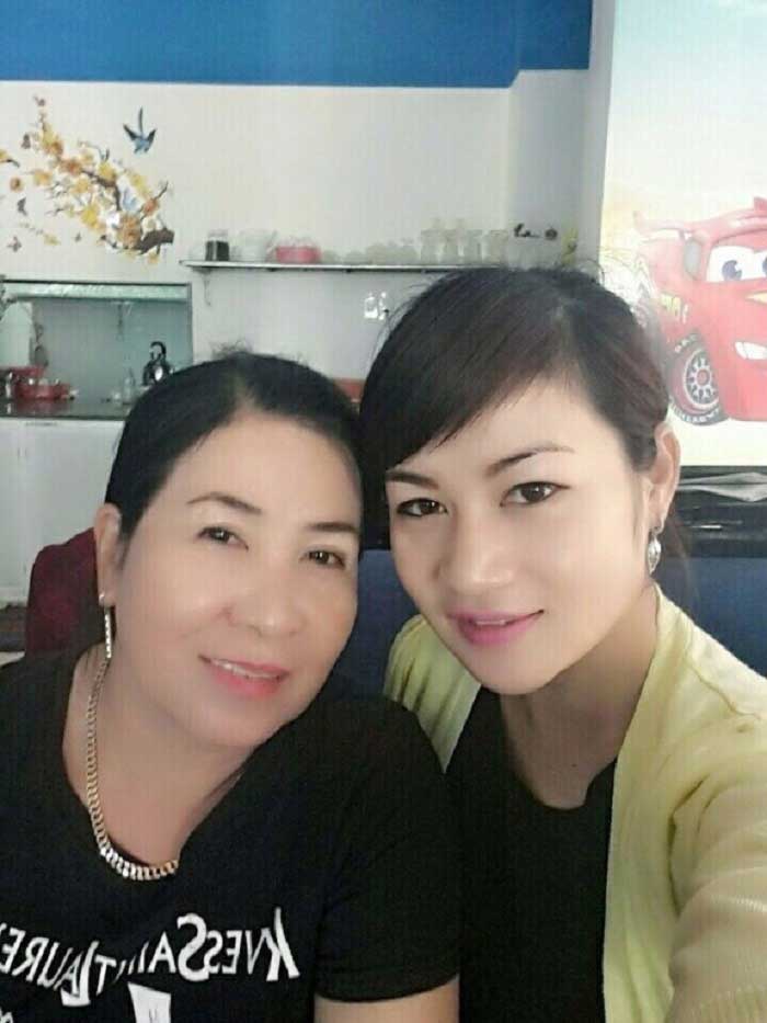 Cắt mí mắt