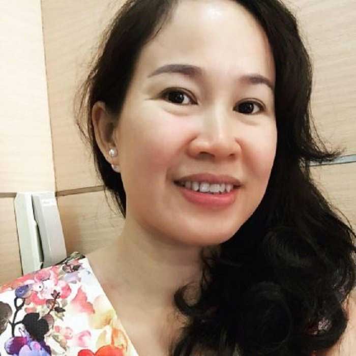 Cắt mí mắt