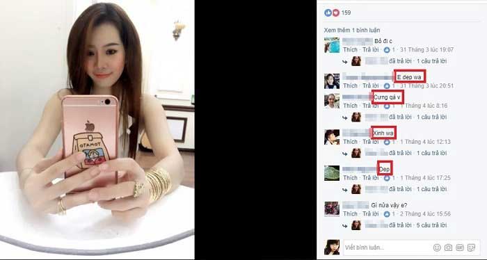 Nâng mũi bọc sụn