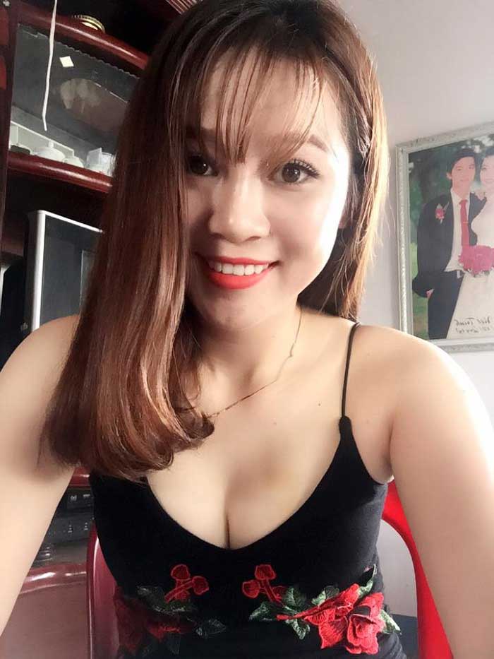 Nâng mũi bọc sụn