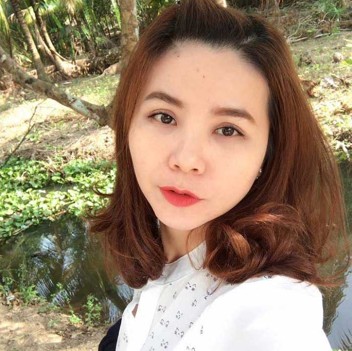 Cắt mí mắt