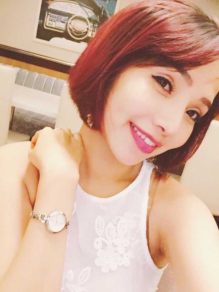 Cắt mí mắt
