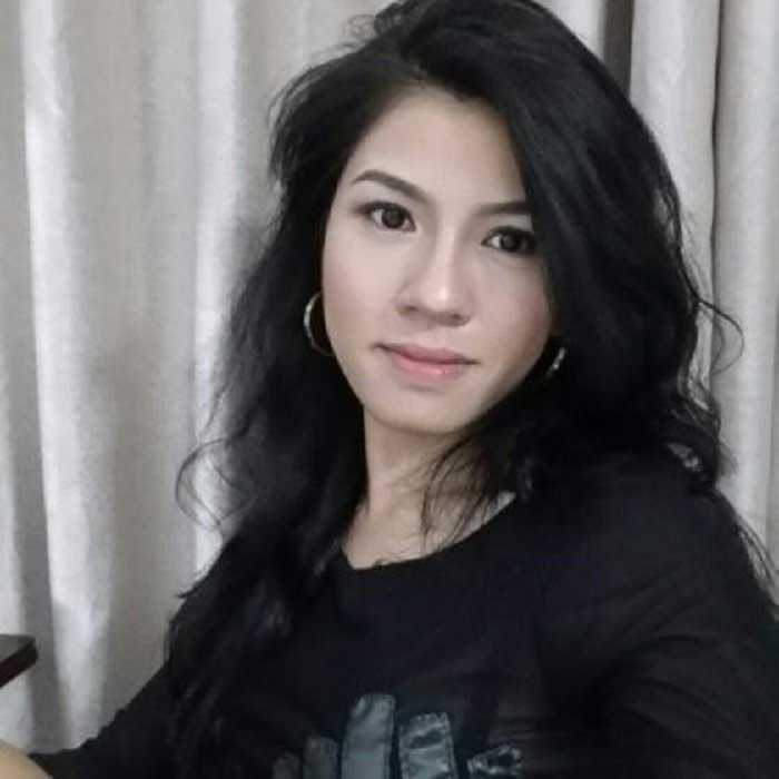 Lấy mỡ má