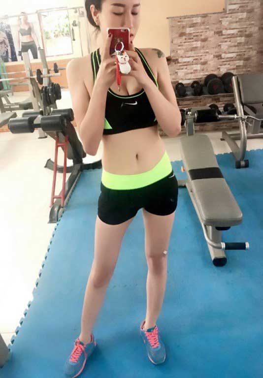Nâng ngực nội soi