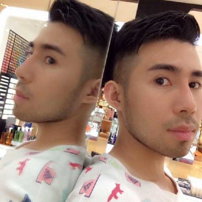 Lấy mỡ má