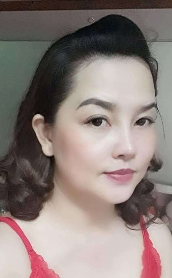 Nâng mũi bọc sụn