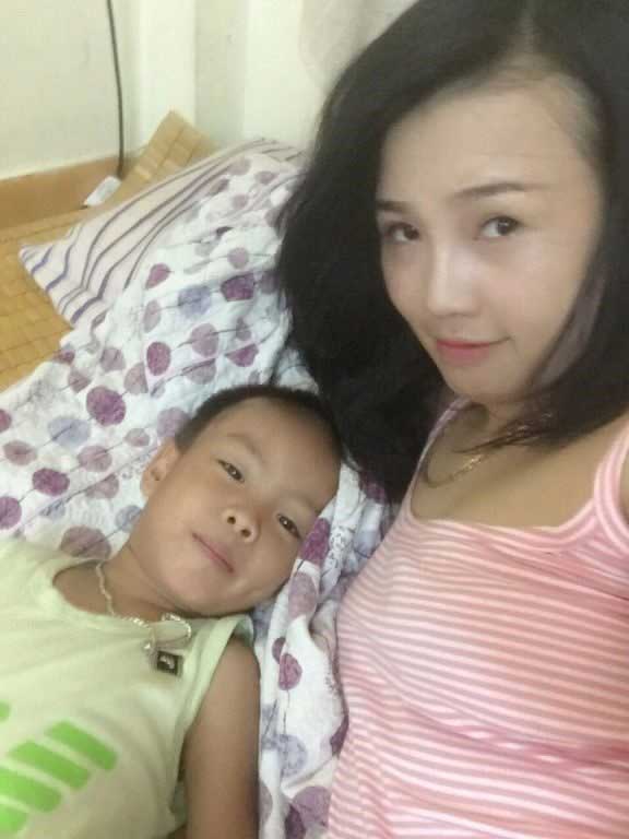 Bấm mí Hàn Quốc