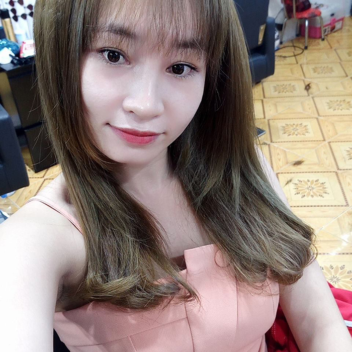 Nâng mũi bọc sụn