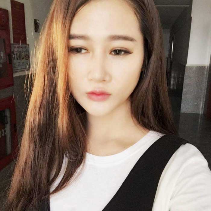 Nâng mũi Hàn Quốc