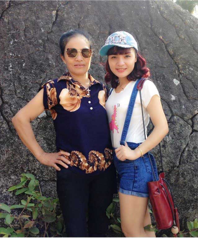 Gọt cằm