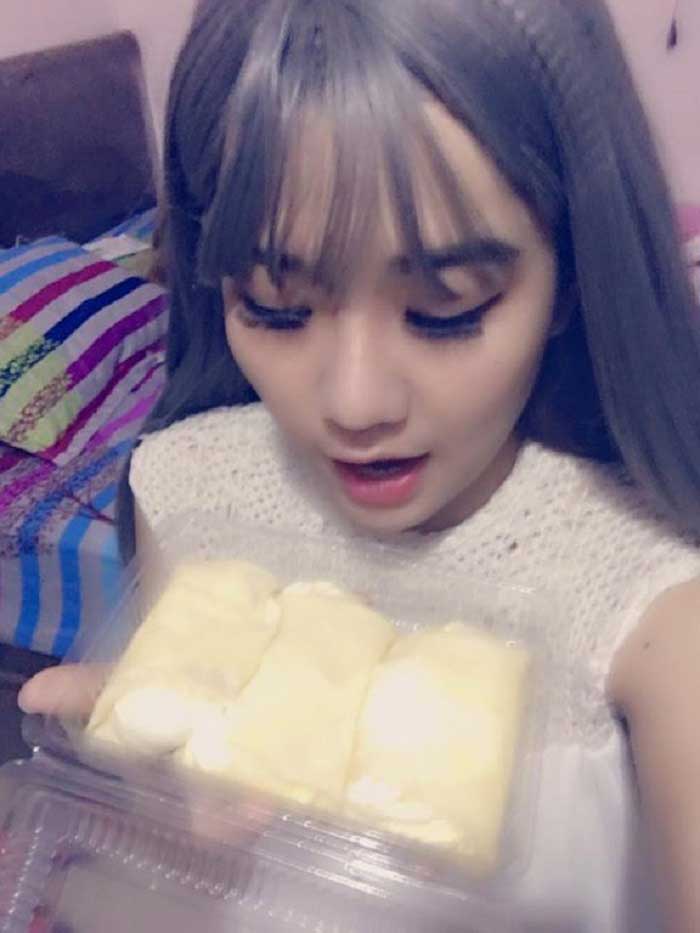Nâng mũi bọc sụn