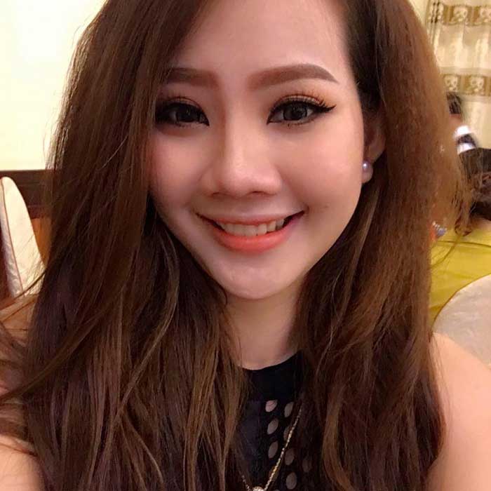 Bấm mí Hàn Quốc