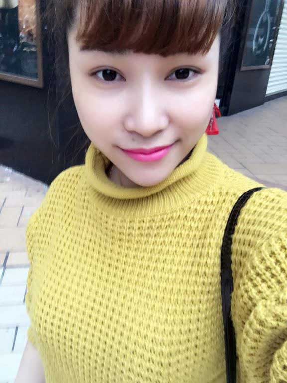 Độn cằm