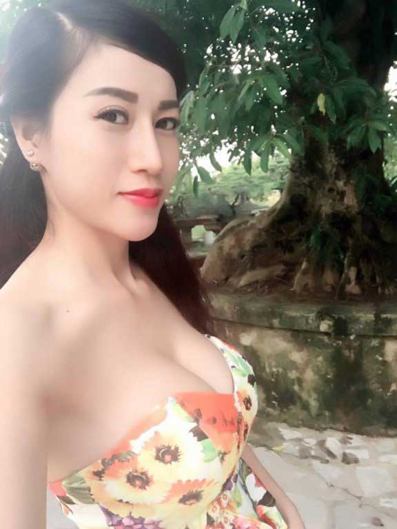 Nâng ngực nội soi