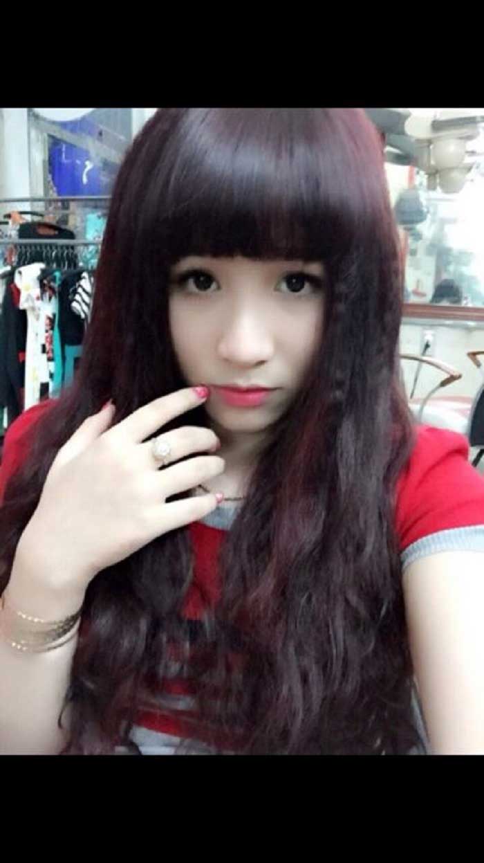 Nâng mũi bọc sụn