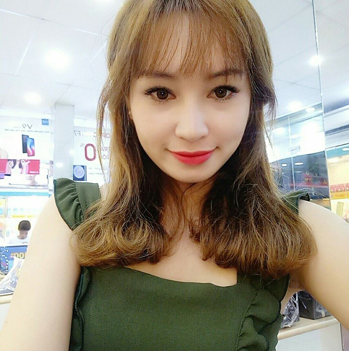 Nâng mũi bọc sụn