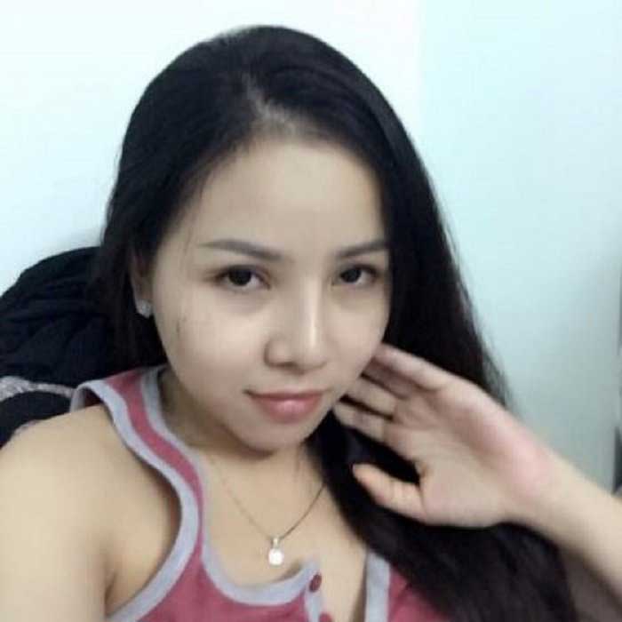 Nâng mũi Hàn Quốc