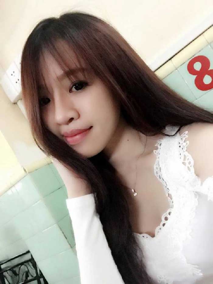 Nâng mũi bọc sụn