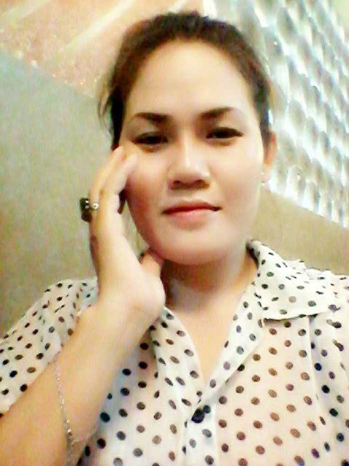 Nâng mũi bọc sụn