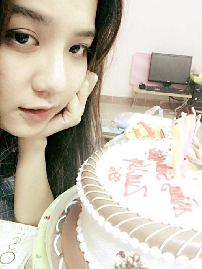 Nâng mũi bọc sụn