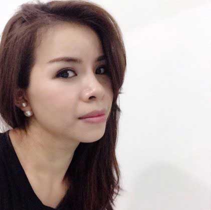 Bấm mí Hàn Quốc