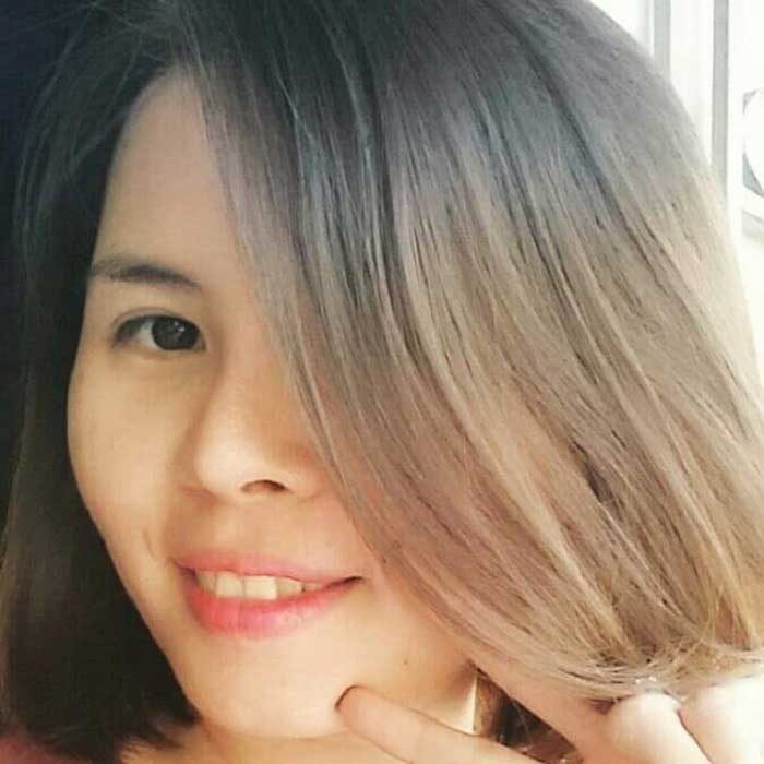 Nâng mũi bọc sụn Nâng mũi bọc sụn