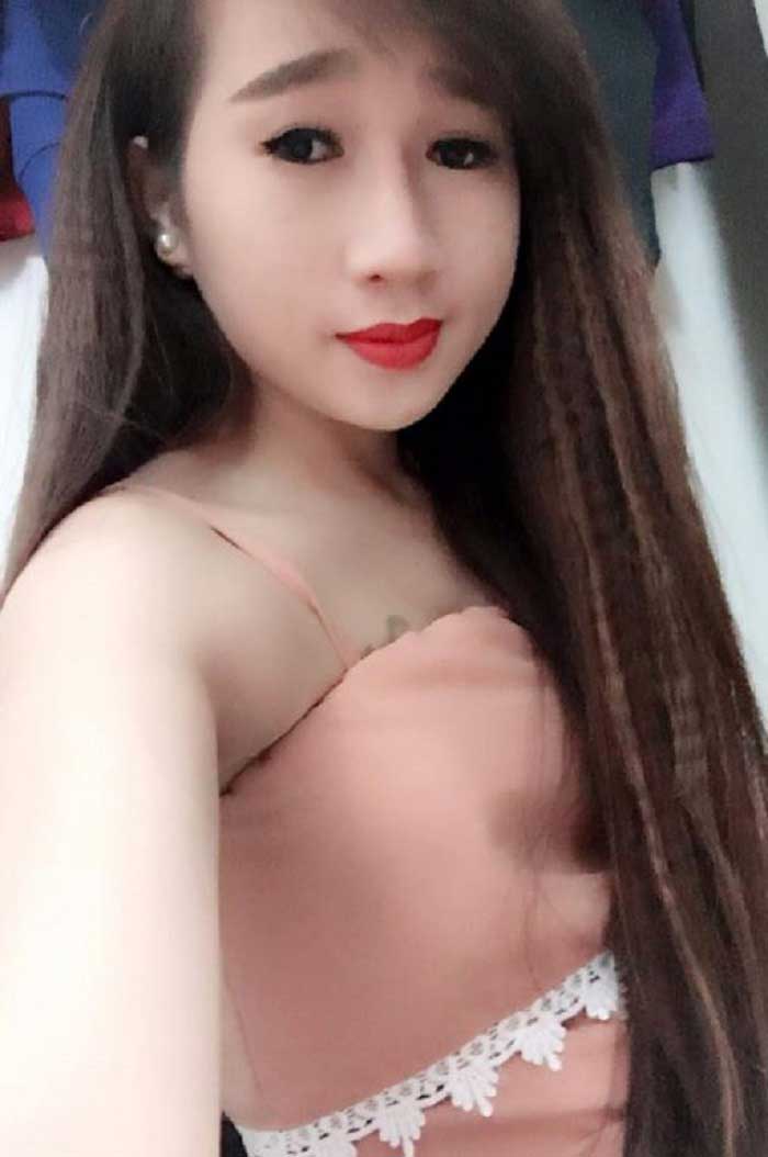 Nâng mũi bọc sụn