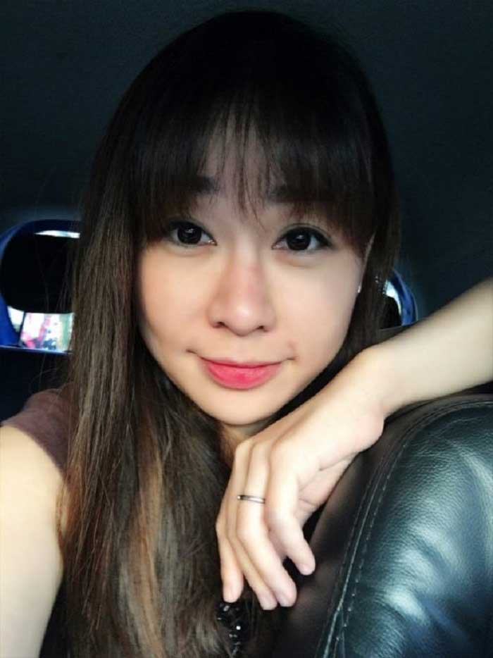 Cắt mí mắt