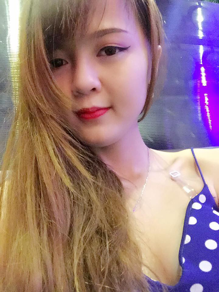 Nâng mũi bọc sụn