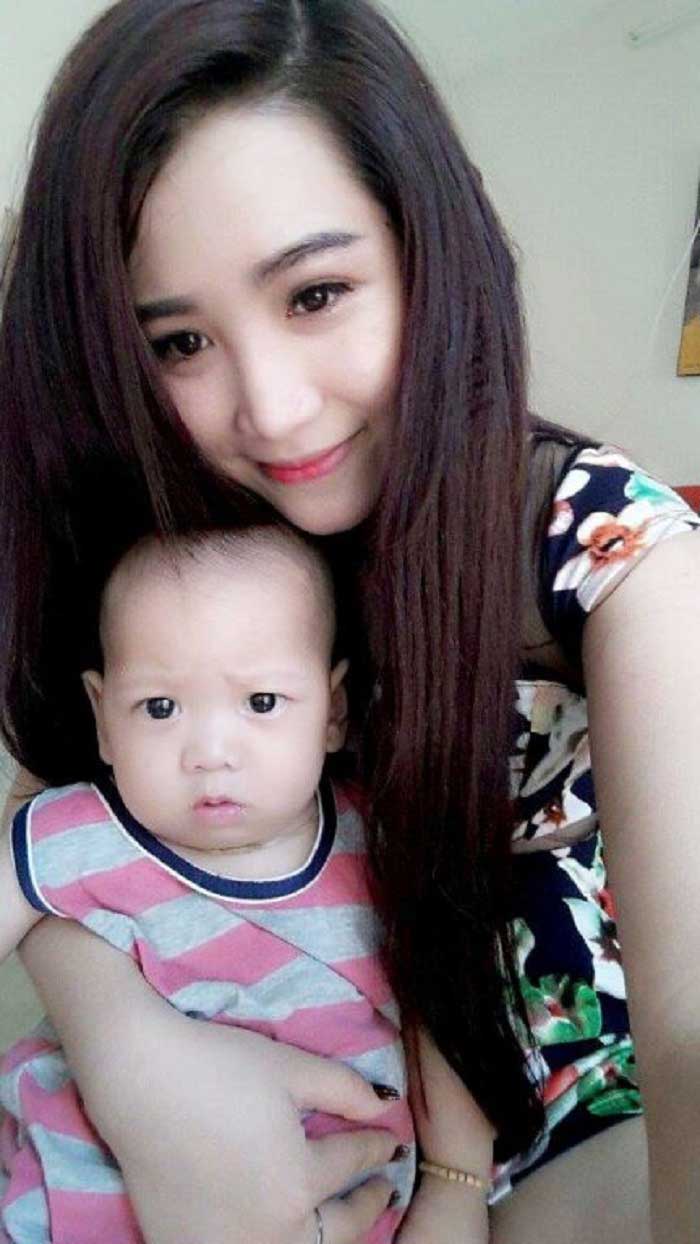 Nâng mũi bọc sụn