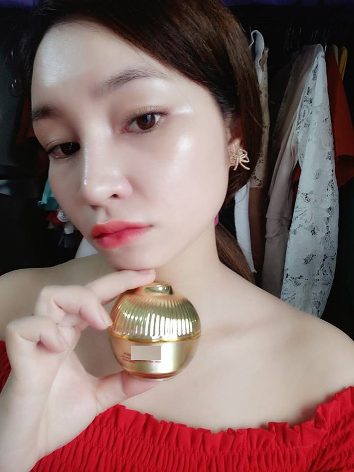 Nâng mũi bọc sụn