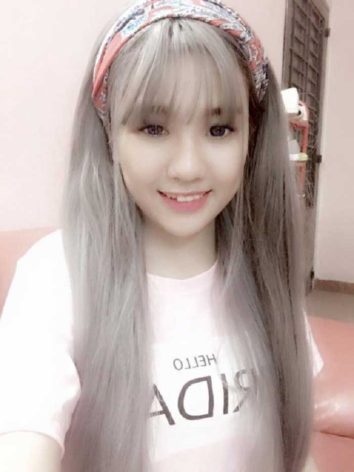 Nâng mũi bọc sụn