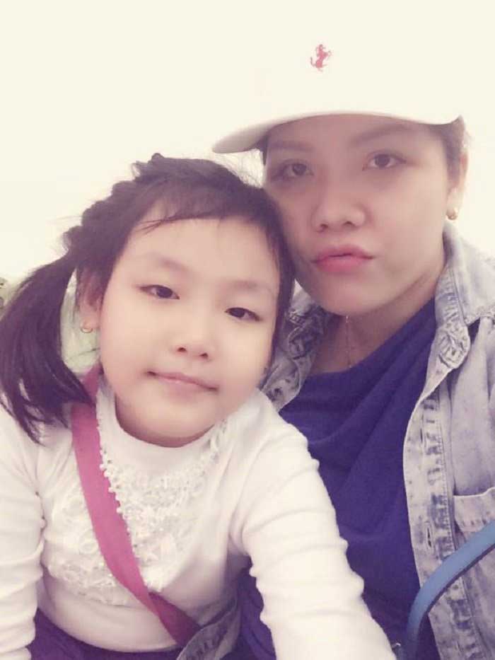 Cắt mí mắt