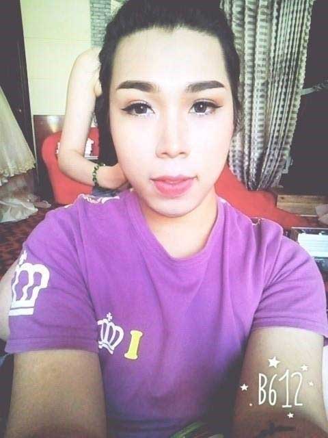 Bấm mí Hàn Quốc