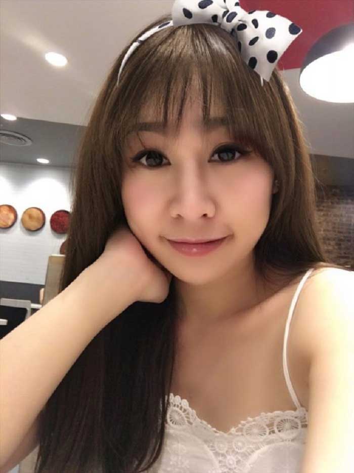 Cắt mí mắt