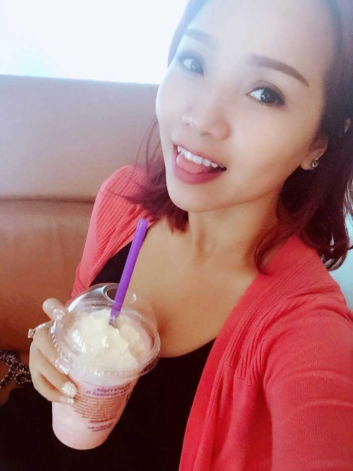 Cắt mí mắt