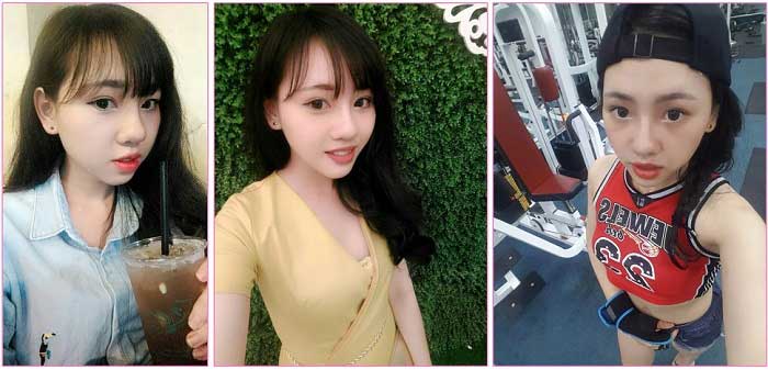 Độn cằm