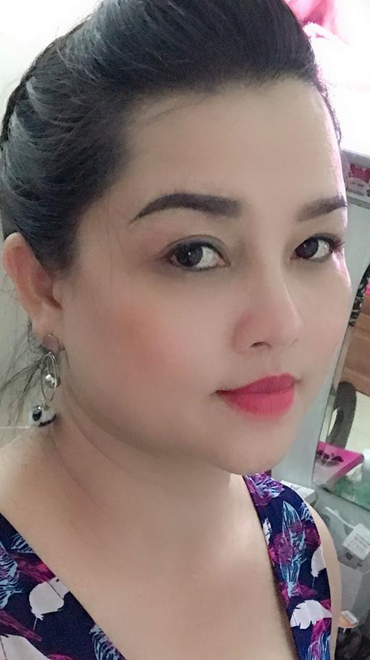 Nâng mũi bọc sụn